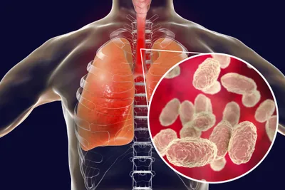 bordetella pertussis bacteria in human airways