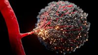 Pediatric leukemias: clinical validation of Oxford Nanopore-based gene expression profiling