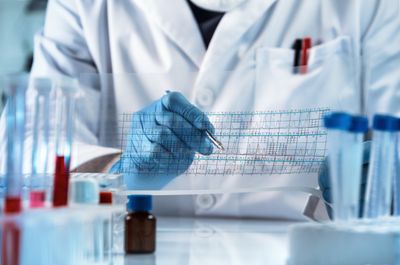 DNA Sequence Analysis
