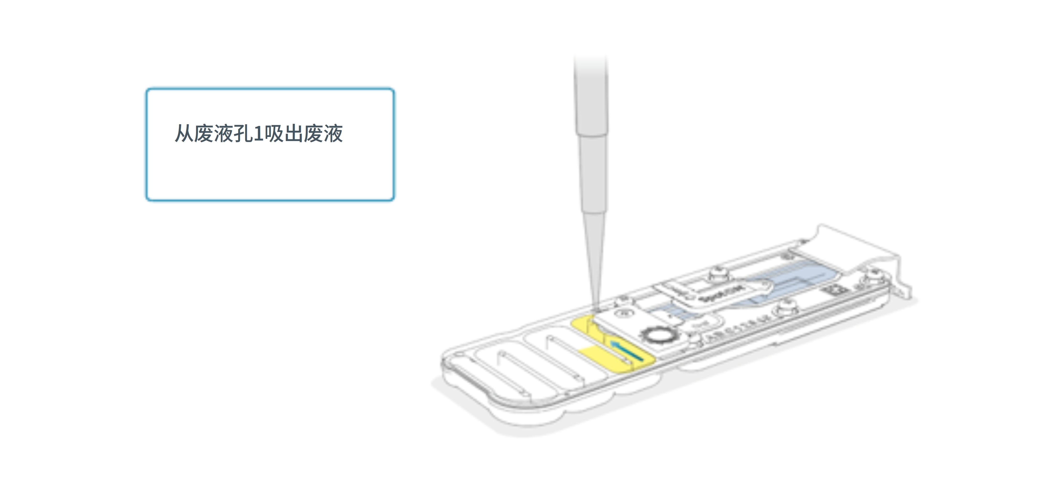 Chinese_Remove_waste_buffer_port_1_Min_grid