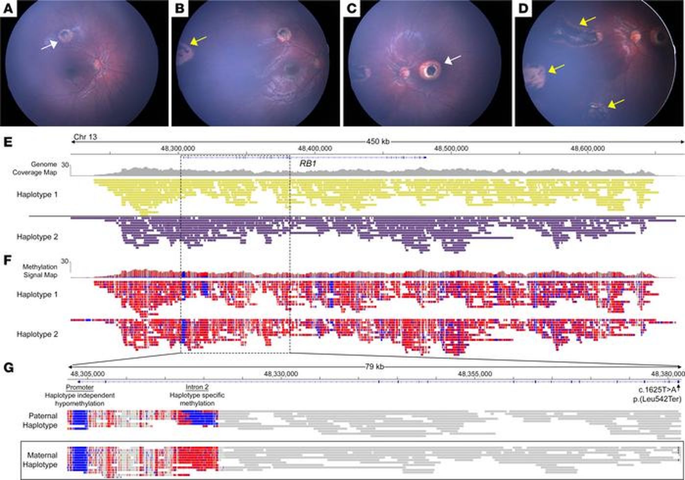 Targeted nanopore sequencing to assign parent of origin