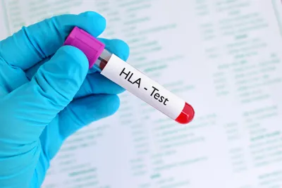 DR2S: an integrated algorithm providing reference-grade haplotype sequences from heterozygous samples