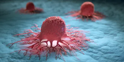 cancer cells