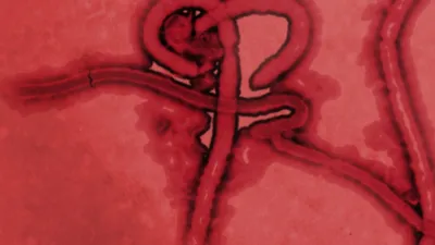 Real-time, portable genome sequencing for Ebola surveillance.
