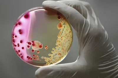 Bacteria