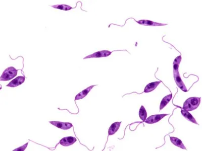 Direct RNA sequencing reveals selective remodelling of the host m6A epitranscriptome during *Leishmania* infection