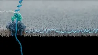 Nanopore sequencing combined with Adaptive Sampling and NanoExpansion enables accurate characterisation of repeat expansion disorders
