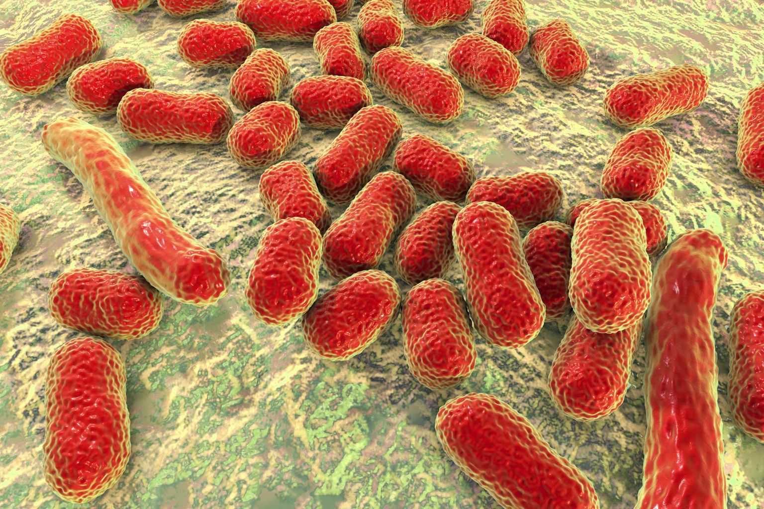 WGS of a cluster of MDR *Shigella sonnei* utilising Oxford Nanopore R10.4.1 long-read sequencing