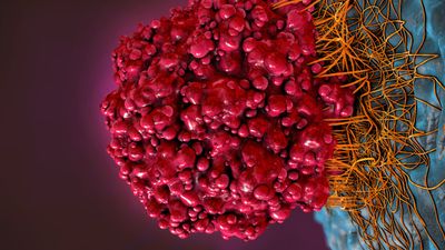 Nanopore sequencing reveals novel alternative splice variants of *EZH2* in paediatric medulloblastoma