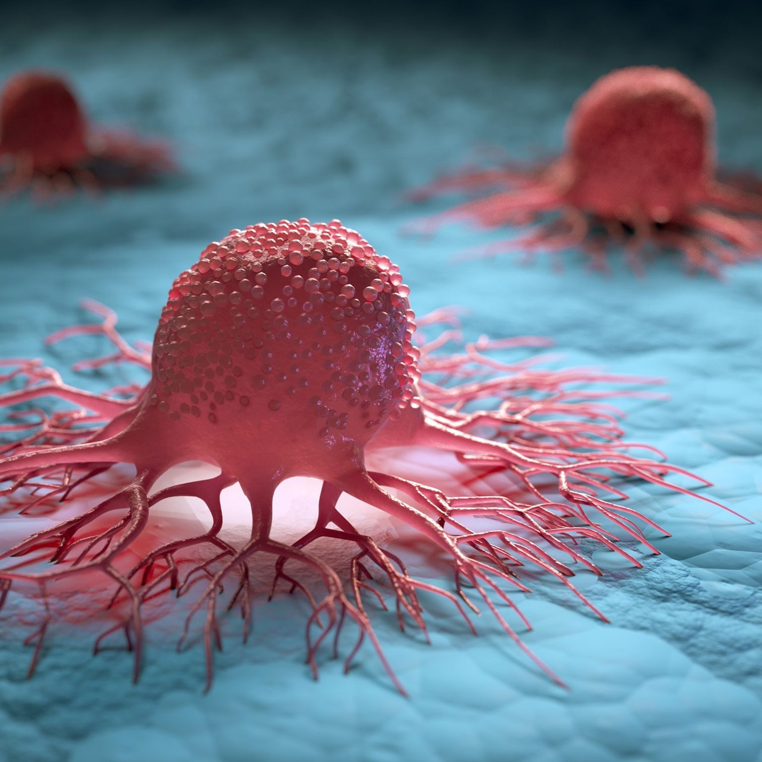 London Calling 2023: Potential clinical utility of long-read sequencing in myeloid neoplasms