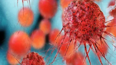cancer cells