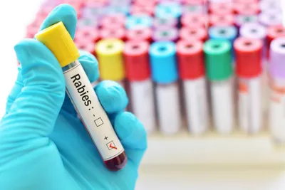 Rabies virus test